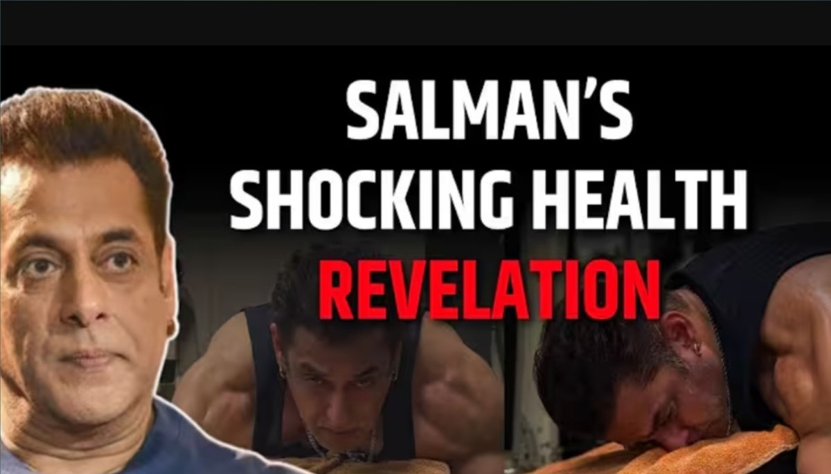 Salman Khan brain aneurysm AV malformation